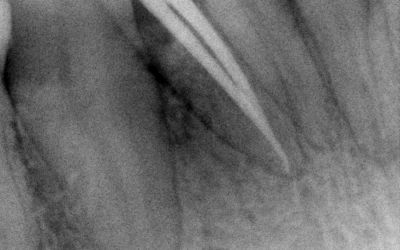 Endodoncie 1